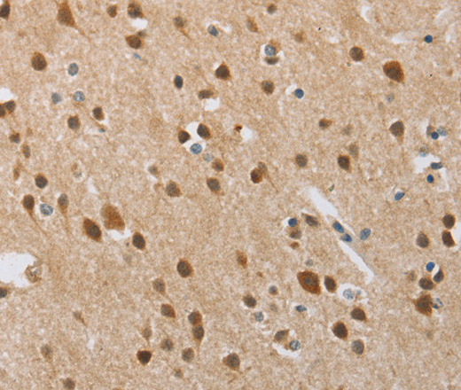 Immunohistochemistry of paraffin-embedded Human brain tissue using FASLG Polyclonal Antibody at dilution 1:30