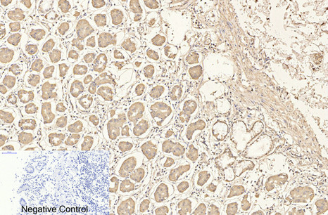 Immunohistochemistry of paraffin-embedded Human stomach tissue using CD4 Monoclonal Antibody at dilution of 1:200.