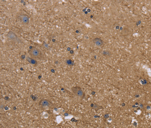 Immunohistochemistry of paraffin-embedded Human brain  using c-Rel Polyclonal Antibody at dilution of 1:50