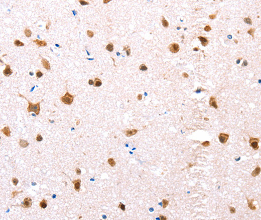 Immunohistochemistry of paraffin-embedded Human brain tissue using ER alpha Polyclonal Antibody at dilution 1:76