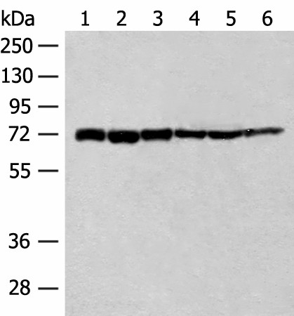 Western blot analysis of 293T cell Human fetal brain tissue Jurkat cell Hela cell Mouse heart tissue lysates  using TCF25 Polyclonal Antibody at dilution of 1:250