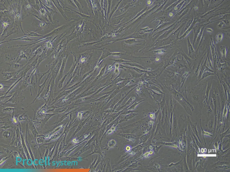 Mouse Pancreatic Stellate Cell Complete Medium - 1