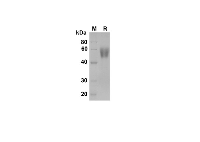 Recombinant Mouse CD4/LEU3 Protein(His Tag)-产品推荐-1