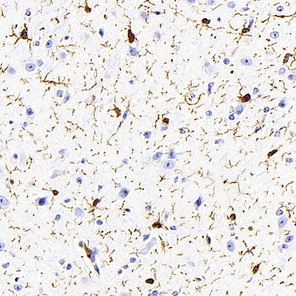 Immunohistochemistry analysis of paraffin-embedded mouse brain  using AIF1 Monoclonal Antibody at dilution of 1:400.