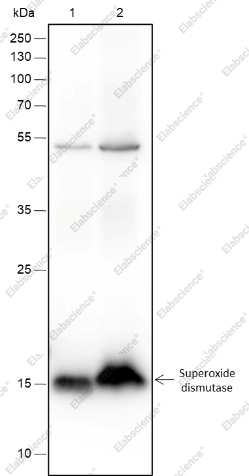 Recombinant SOD1 Monoclonal Antibody - 2