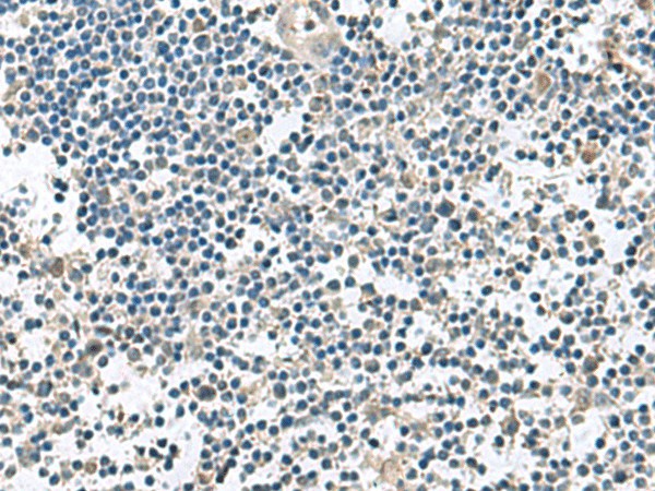 Immunohistochemistry of paraffin-embedded Human tonsil tissue  using VEGFA Polyclonal Antibody at dilution of 1:45(?200)