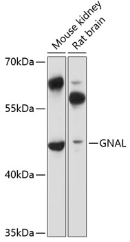 Western blot analysis of extracts of various cell lines using GNAL Polyclonal Antibody at 1:3000 dilution.