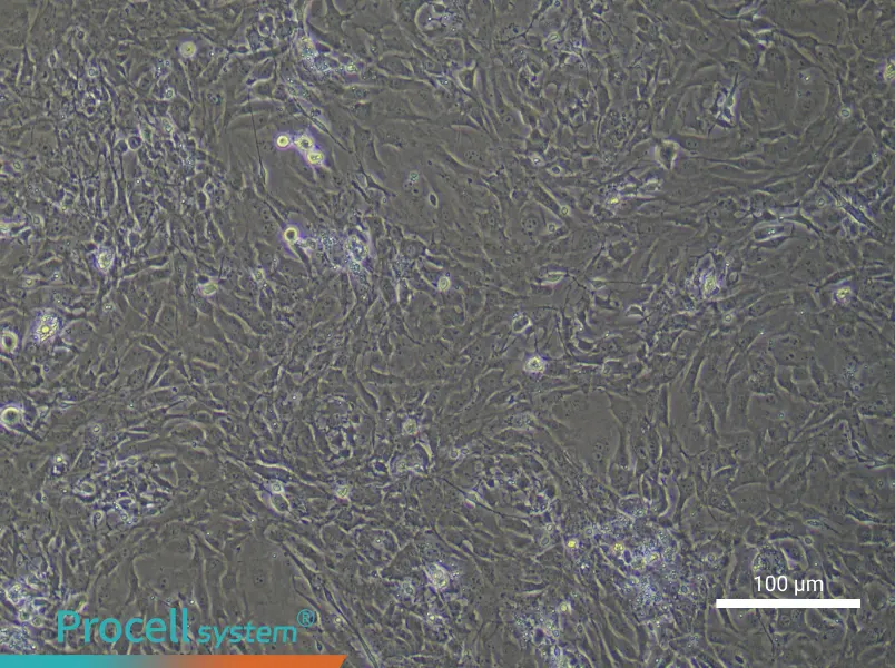 Mouse Trabecular Meshwork CellsMouse Trabecular Meshwork Cells - 2