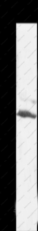 SLC16A7 Polyclonal Antibody - 1