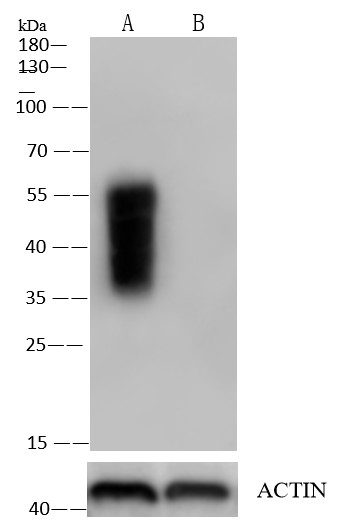 Recombinant CD147/EMMPRIN/Basigin Monoclonal Antibody - small - 11