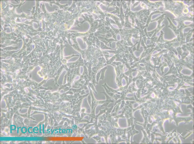 LNCaP clone FGC Cell Complete Medium - small - 4