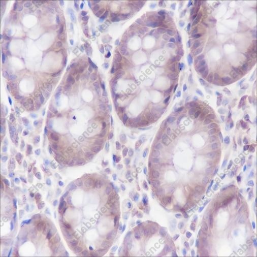Recombinant alpha Actinin 4 Monoclonal Antibody - 2