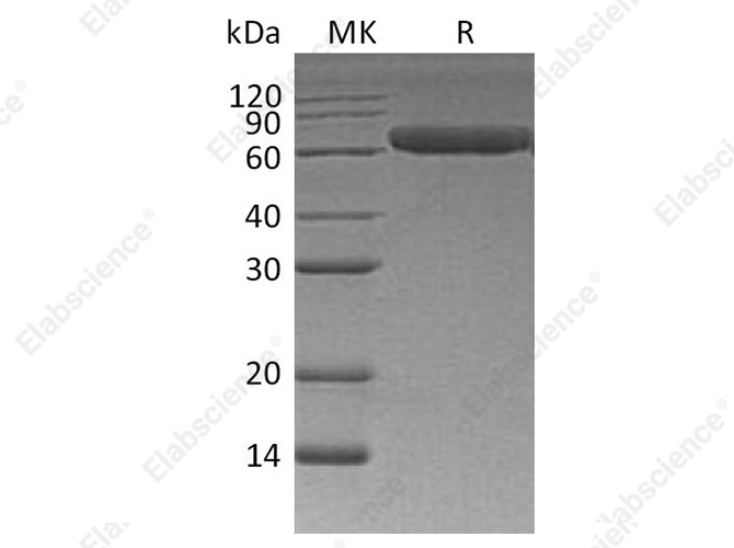 Recombinant Human ROR1 Protein (His Tag) - 1