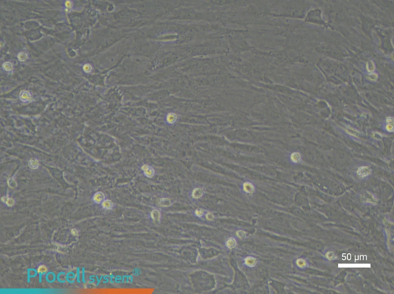 Rat Pancreatic Stellate Cell Complete Medium - 4