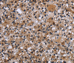 c-Rel Polyclonal Antibody - 3