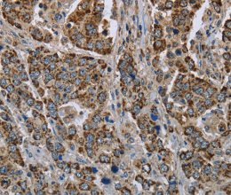 GOT2 Polyclonal Antibody - 3