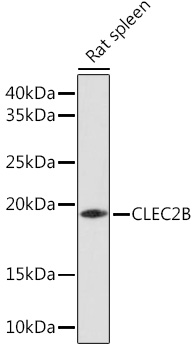 Western blot analysis of extracts of Rat spleen using CLEC2B Polyclonal Antibody at 1:1000 dilution.