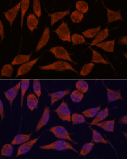 Immunofluorescence analysis of L929 cells using TRAPPC6A Polyclonal Antibody at dilution of  1:100. Blue: DAPI for nuclear staining.