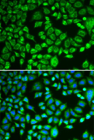 Immunofluorescence analysis of MCF-7 cells using PSMD7 Polyclonal Antibody