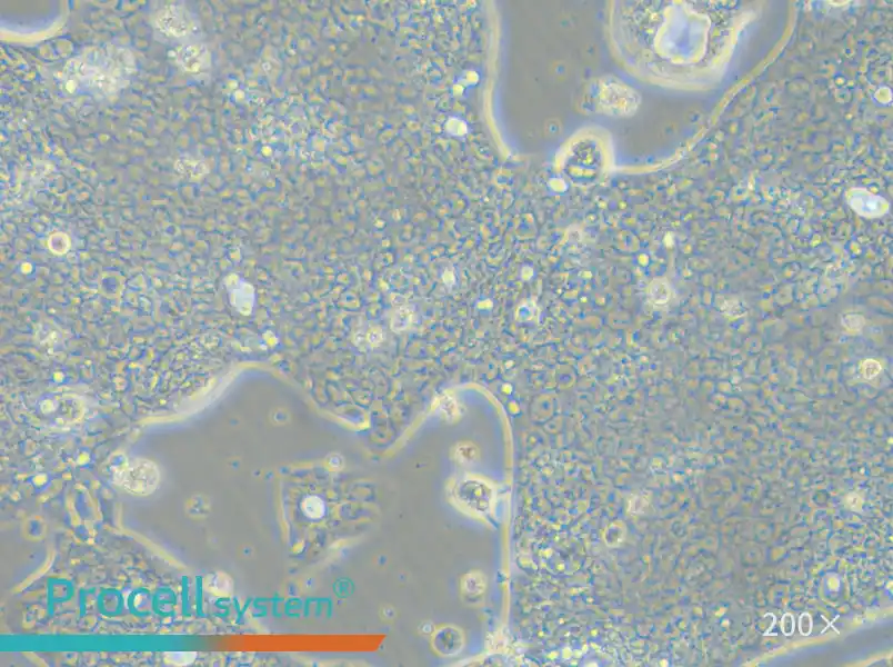 NCI-N87 [N87] Cell Complete Medium - small - 6