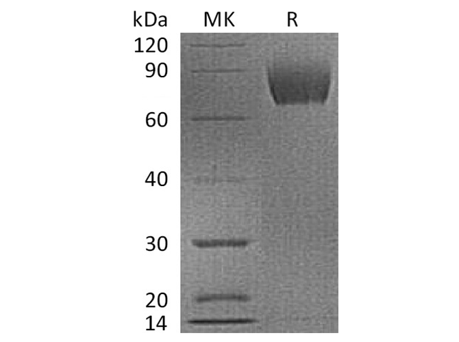Recombinant Cynomolgus B7-H3/CD276 Protein (His Tag)