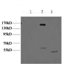 Western Blot analysis of 1) Hela, 2) 293, 3) Jurkat cells using ERBB2 Monoclonal Antibody at dilution of 1:2000.