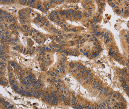 KCNK9 Polyclonal Antibody - 3