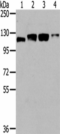 Western Blot analysis of Human fetal brain tissue, 231, 293T and Hela cells using UBA1 Polyclonal Antibody at dilution of 1/400