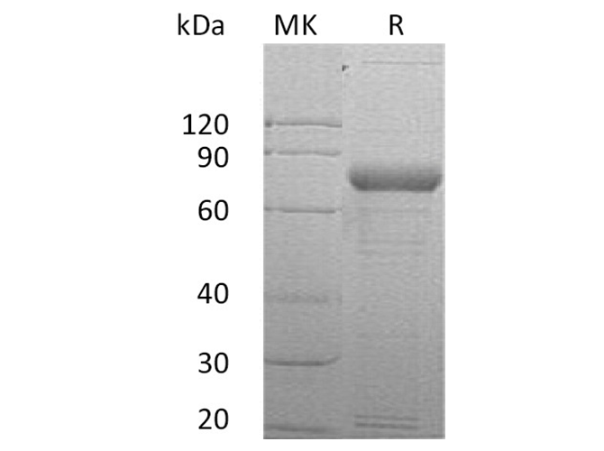 Recombinant Human SIRP gamma/CD172g Protein (Fc Tag)