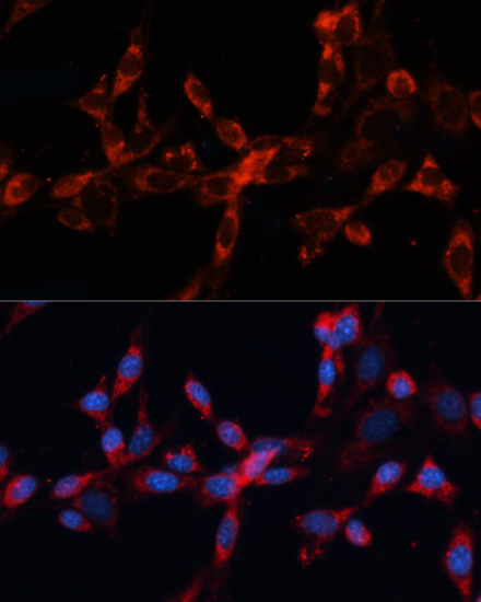 Immunofluorescence analysis of NIH/3T3 cells using CTSL Polyclonal Antibody at dilution of  1:100. Blue: DAPI for nuclear staining.