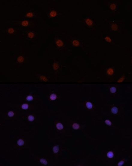 Immunofluorescence analysis of C6 cells using DNMT3B Polyclonal Antibody at dilution of  1:100. Blue: DAPI for nuclear staining.