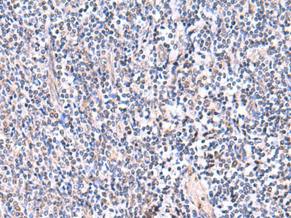 Immunohistochemistry of paraffin-embedded Human tonsil tissue  using FDFT1 Polyclonal Antibody at dilution of 1:75(?200)