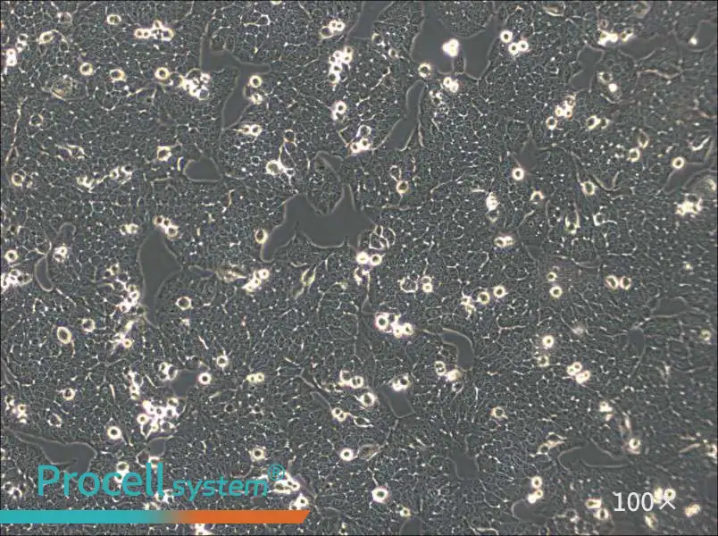 WSU-HN30 Cell Complete Medium - 1
