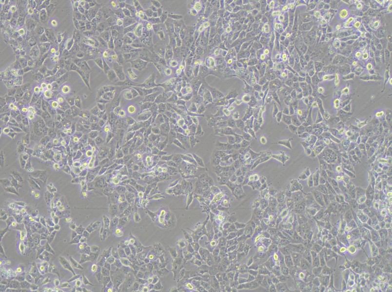 NCI-H1915 Cell Complete Medium - 3