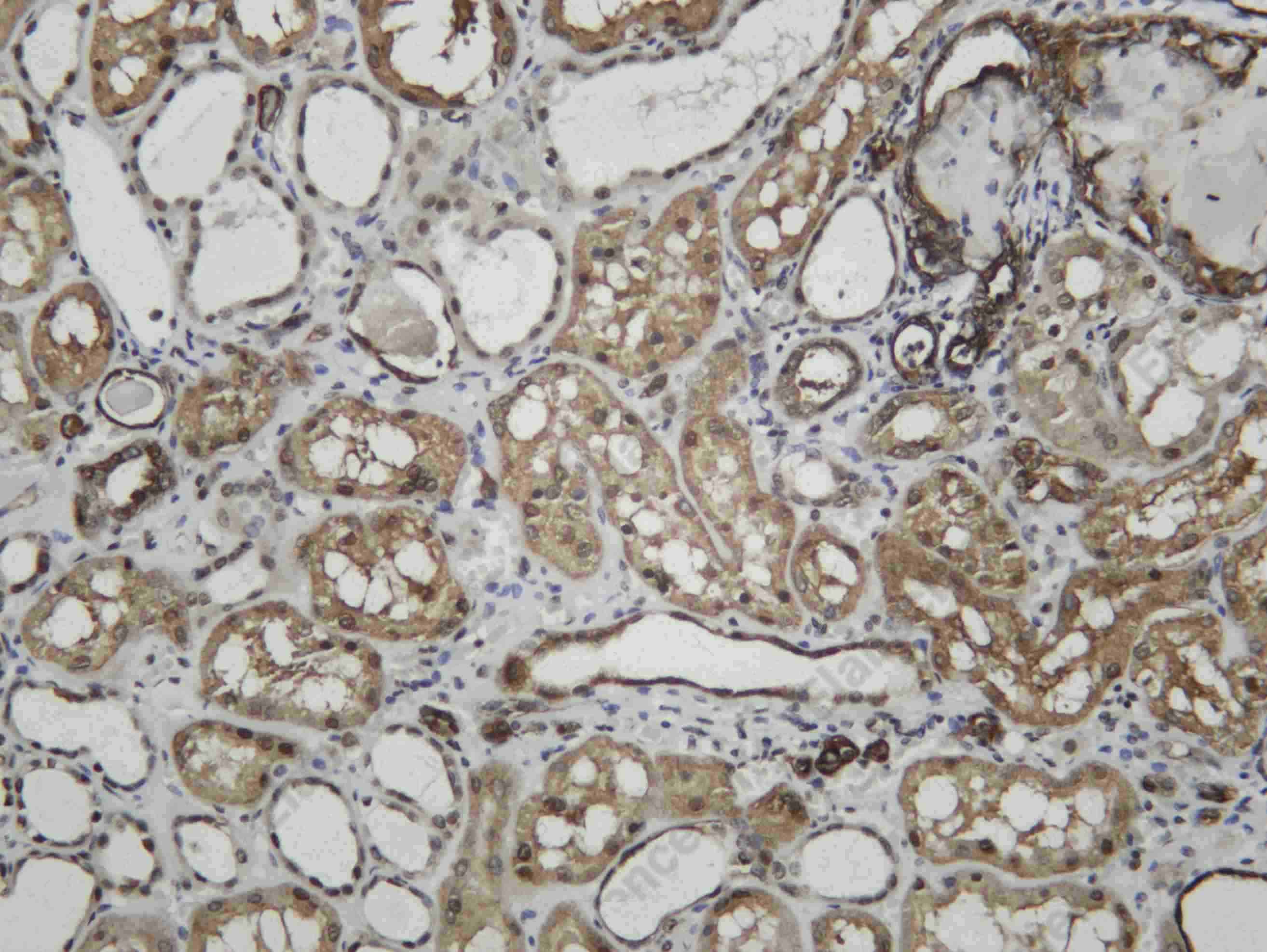 Recombinant Histone H4 (Mono Methyl Lys20) Monoclonal Antibody - 2