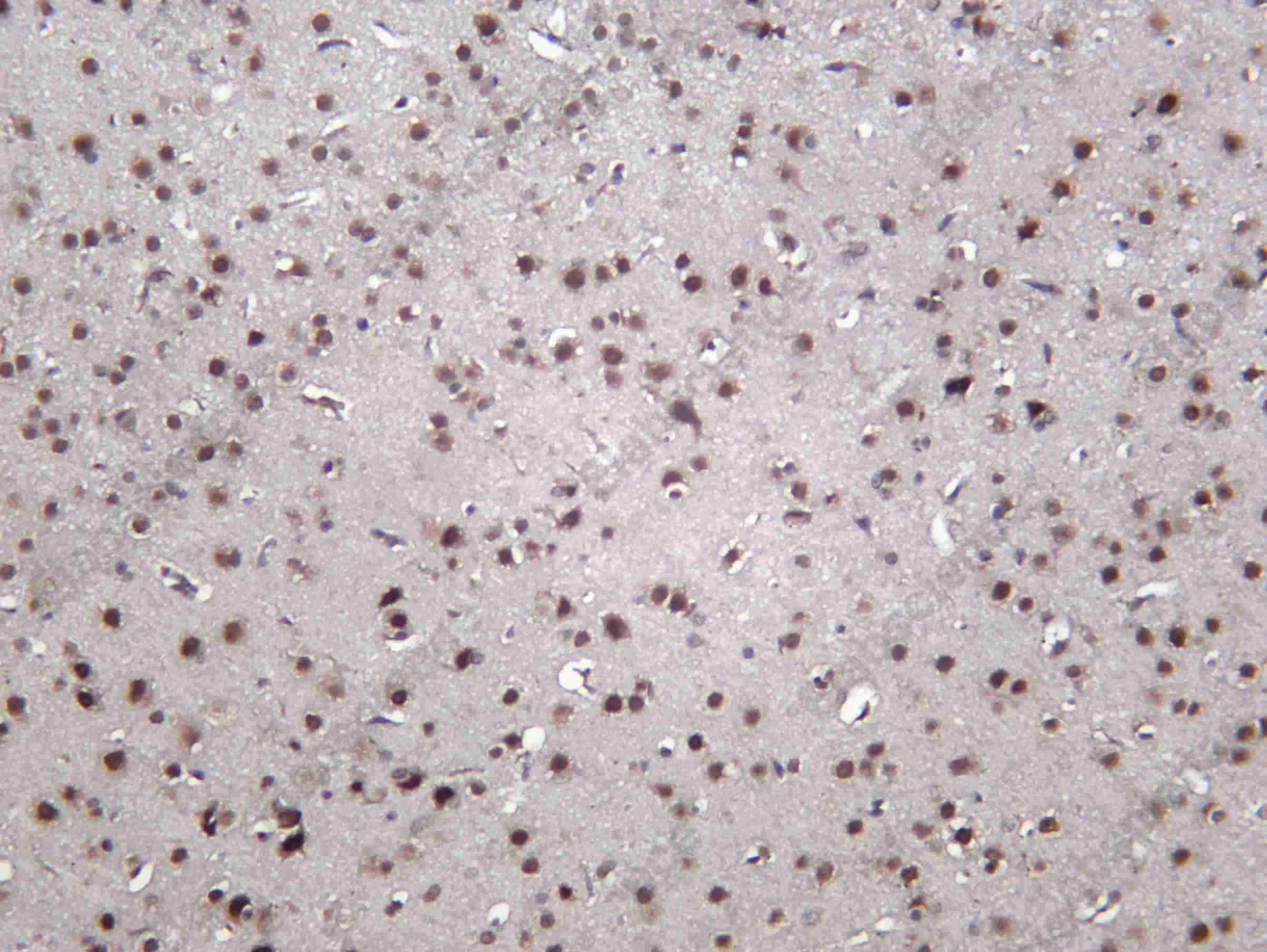 Recombinant D3DR Monoclonal Antibody - 1