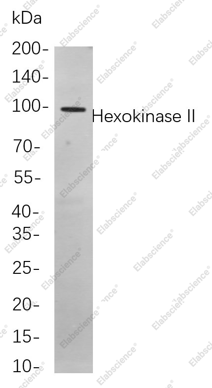 Recombinant Hexokinase II Monoclonal Antibody - 1
