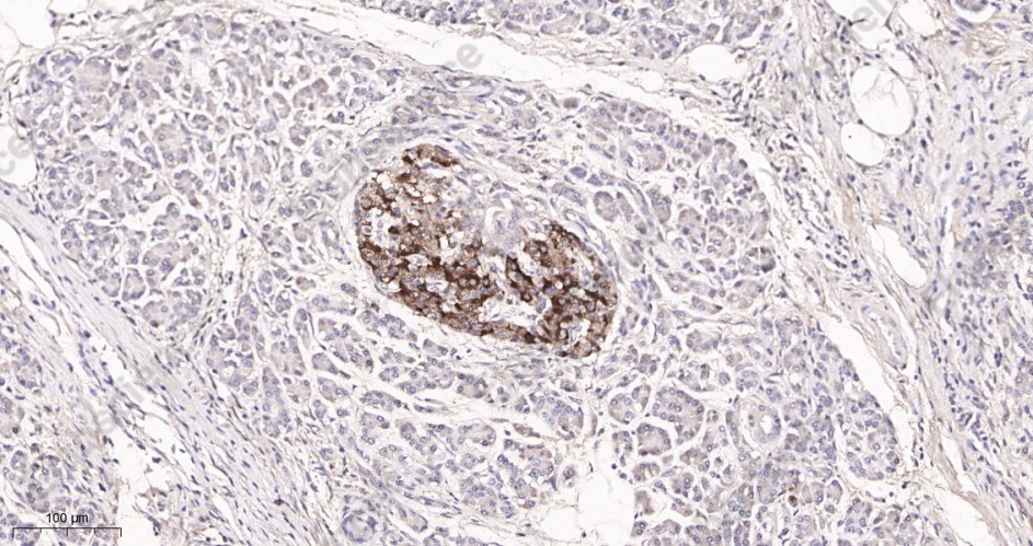 Recombinant PTEN Monoclonal Antibody - 3
