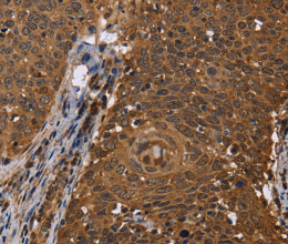 DCP1A Polyclonal Antibody - 2