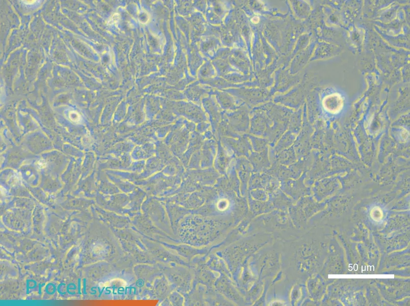 MHCC97-H Cell Complete Medium - 5