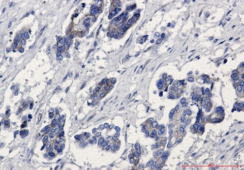 Recombinant beta-Catenin/CTNNB1 Monoclonal Antibody - 3