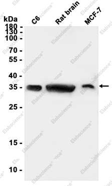 Recombinant GNB3 Monoclonal Antibody - 1