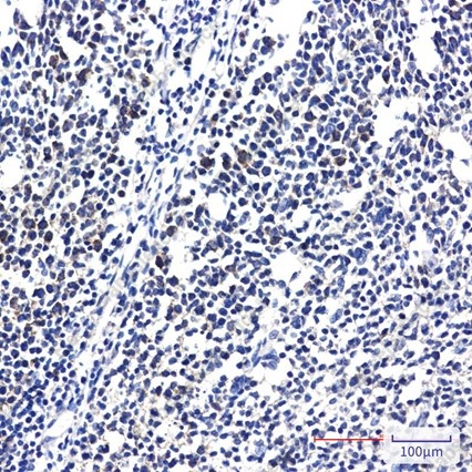 Recombinant RPS20 Monoclonal Antibody - 3