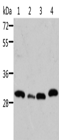 Western Blot analysis of Mouse pancreas and spleen tissue, Mouse heart tissue and 293T cell using STRADB Polyclonal Antibody at dilution of 1:500