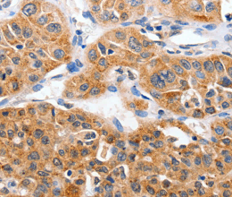 YWHAG Polyclonal Antibody - 2