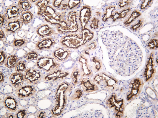 Recombinant ACE Monoclonal Antibody - 1
