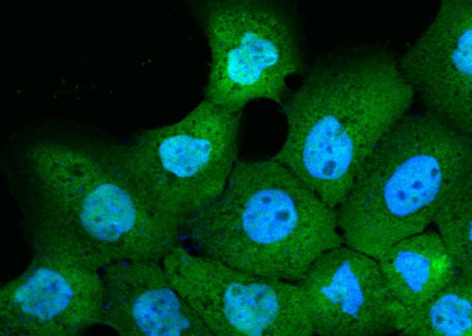 Recombinant CALML5 Monoclonal Antibody - small - 2