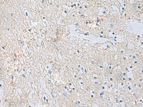 Immunohistochemistry of paraffin-embedded Human brain tissue  using RDH5 Polyclonal Antibody at dilution of 1:50(?200)