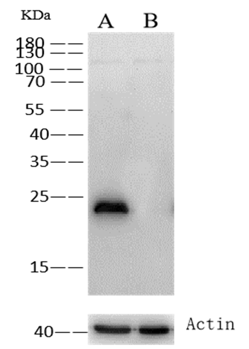 Recombinant GSTP1 Monoclonal Antibody - small - 2