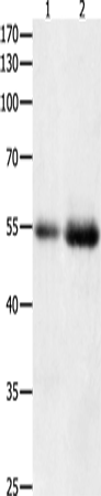 Western Blot analysis of Human colon  and  kidney cancer tissue   using HDAC1 Polyclonal Antibody at dilution of 1:400